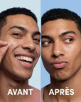 24 Blemish Patches Clear