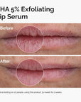 The Soft Lip Set