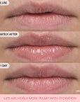 Bouncy and Firm Lip Treatment