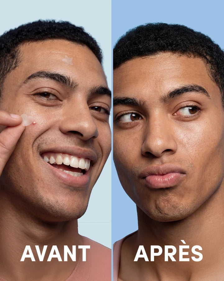 24 Blemish Patches Clear
