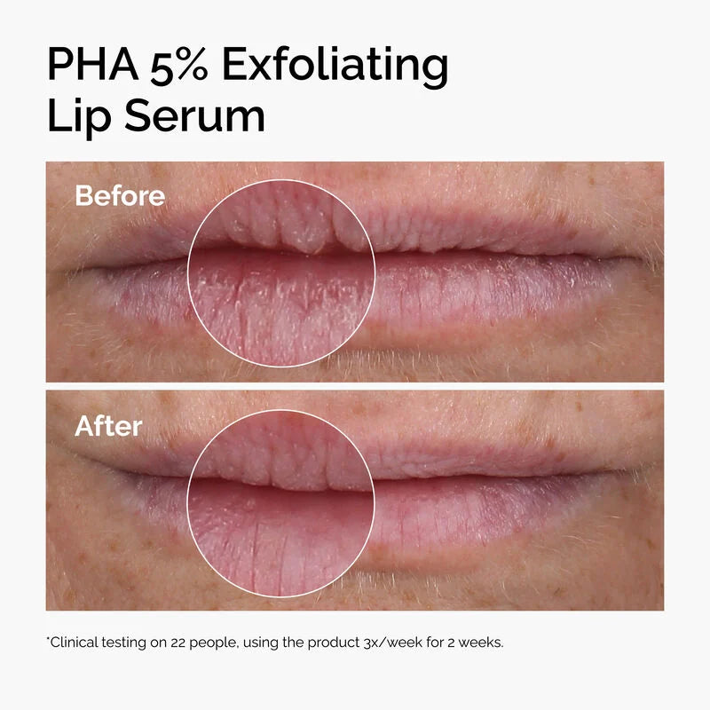 The Soft Lip Set